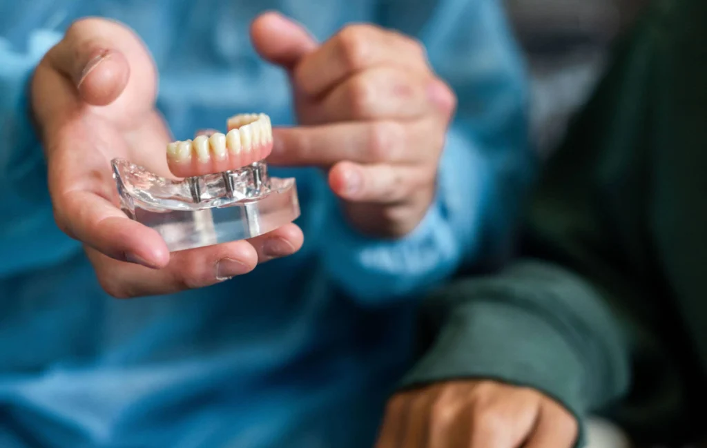 protheses-completes-chirurgien-dentiste-pernes-les-fontaines protheses-completes-chirurgien-dentiste-pernes-les-fontaines Prothèse complète sur implant Dentistes à Pernes-les-Fontaines | Pôle 158