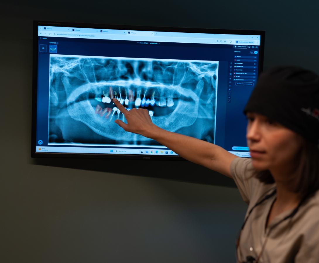 radiographie-dentiste-pernes-les-fontaines Parcours de soins Dentistes à Pernes-les-Fontaines | Pôle 158